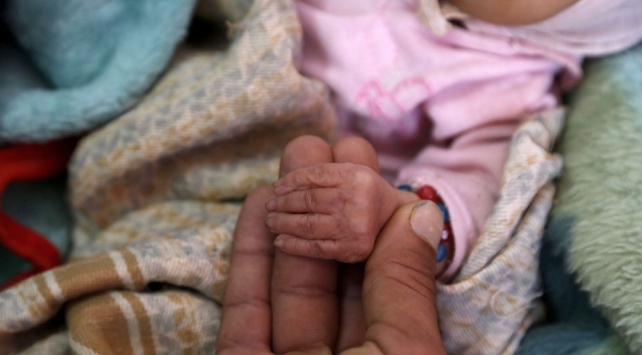 BM’den Yemen’de kıtlık uyarısı